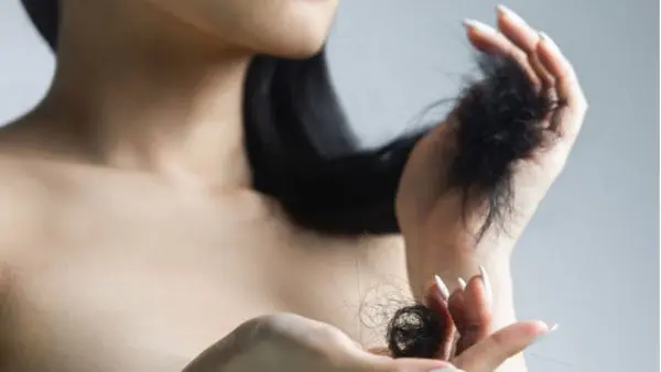 Postpartum Hair Loss